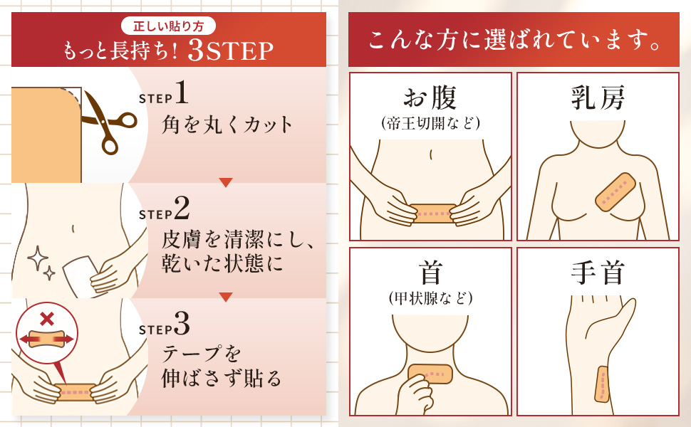 正しい貼り方 もっと長持ち！3STEP：STEP1 角を丸くカット、STEP2 皮膚を清潔にし乾いた状態に、STEP3 テープを伸ばさず貼る。こんな方に選ばれています：お腹（帝王切開など）、乳房、首（甲状腺など）、手首